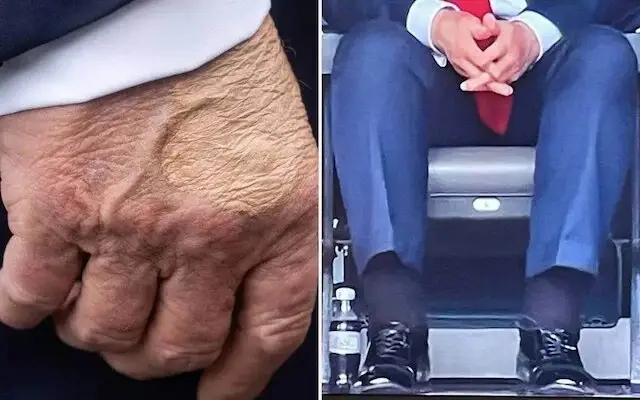 روانشناس آمریکایی: زوال عقل ترامپ در حال شتاب گرفتن است