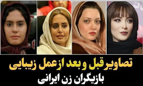 شگفتی‌سازان زیبایی سینما؛ تغییرات حیرت‌انگیز چهره بازیگران زن پس از عمل‌های جراحی