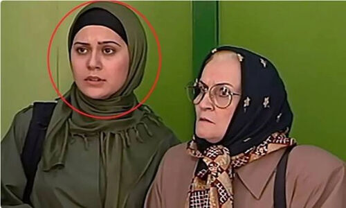 آرام جعفری با نگاهی جذاب پیش از عمل زیبایی؛ رازهای پنهان یک تغییر بزرگ!