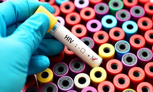پویش «من هم تست HIV می‌دهم» همچنان با استقبال گسترده مردم ادامه دارد