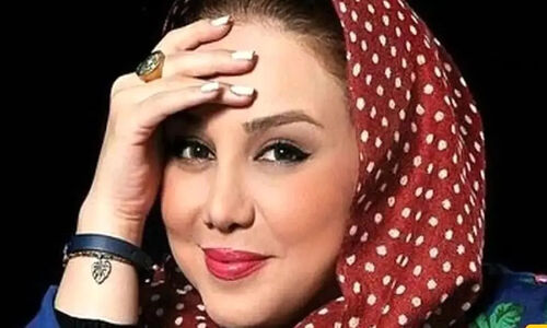 بهنوش بختیاری قبل از عمل بینی؛ آیا واقعا نیازی به جراحی داشت؟