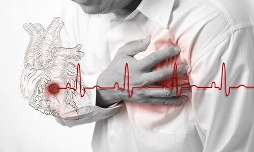 چرا هر ایرانی باید مهارت حیاتی احیای قلبی ریوی را یاد بگیرد؟