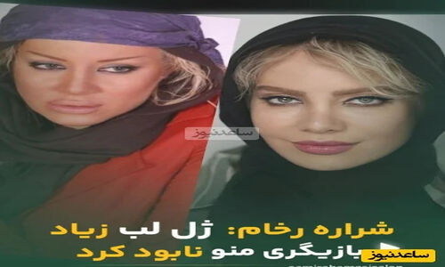 شراره رخام: چگونه تزریق ژل لب، بازیگری‌ام را به خطر انداخت؟ گرایش جدیدم به نچرال بودن را بشنوید!