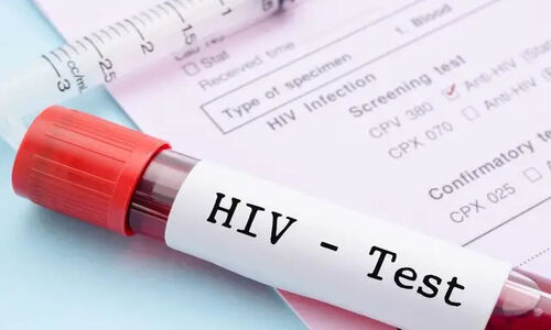 انفجار تست‌های سریع HIV در کردستان؛ بیش از ۴۰۰۰ نفر به دنبال سلامتی!