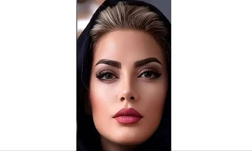 تغییر شگفت‌انگیز چهره طناز طباطبایی؛ بازیگری که همه را متحیر کرد!