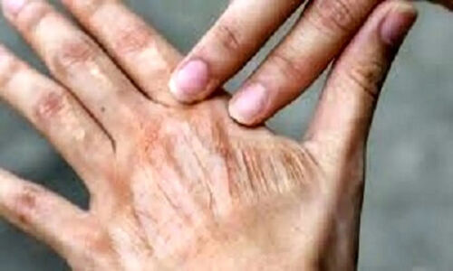 آلودگی هوا چگونه پوست شما را به‌مرور پیر و فرسوده می‌کند؟