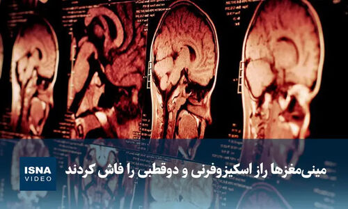 راز شگفت‌انگیز اسکیزوفرنی و دوقطبی در مینی‌مغزهای ساخته‌شده فاش شد!
