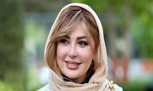 عکس | تغییر چهره نیوشا ضیغمی پس از عمل دوباره بینی