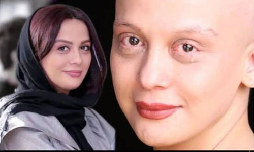 بیوگرافی تلخ مارال فرجاد؛ از بیماری سخت تا سیمرغ بلورین جشنواره فجر