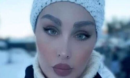 بیوگرافی طلا گلزار+عکس‌های فوق خصوصی